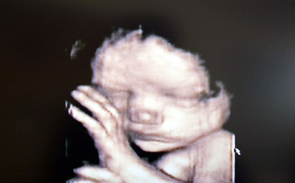Former Planned Parenthood employee shares a big reason why young people are pro-life