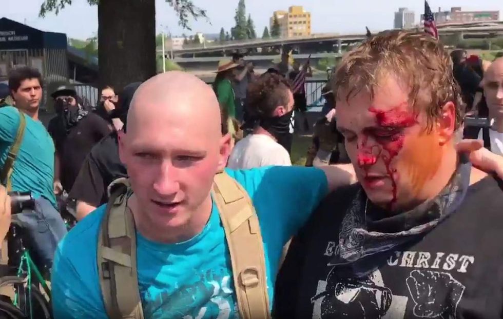 Things get bloody when Antifa thugs attack pro-Trump rally in Portland