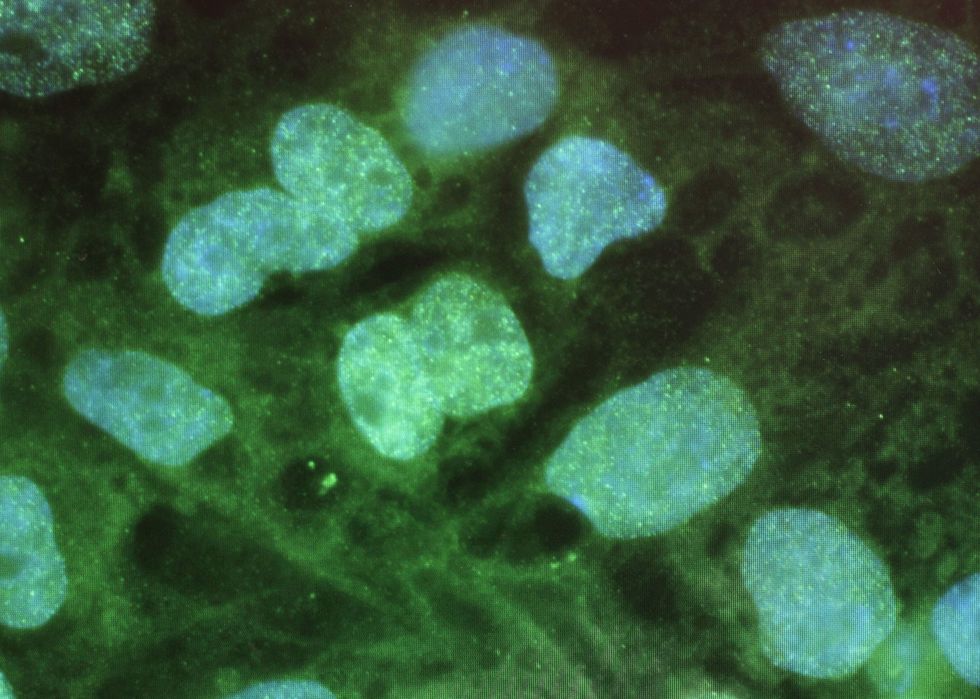 University develops miracle device that can heal organs and tissue in a 'fraction of a second