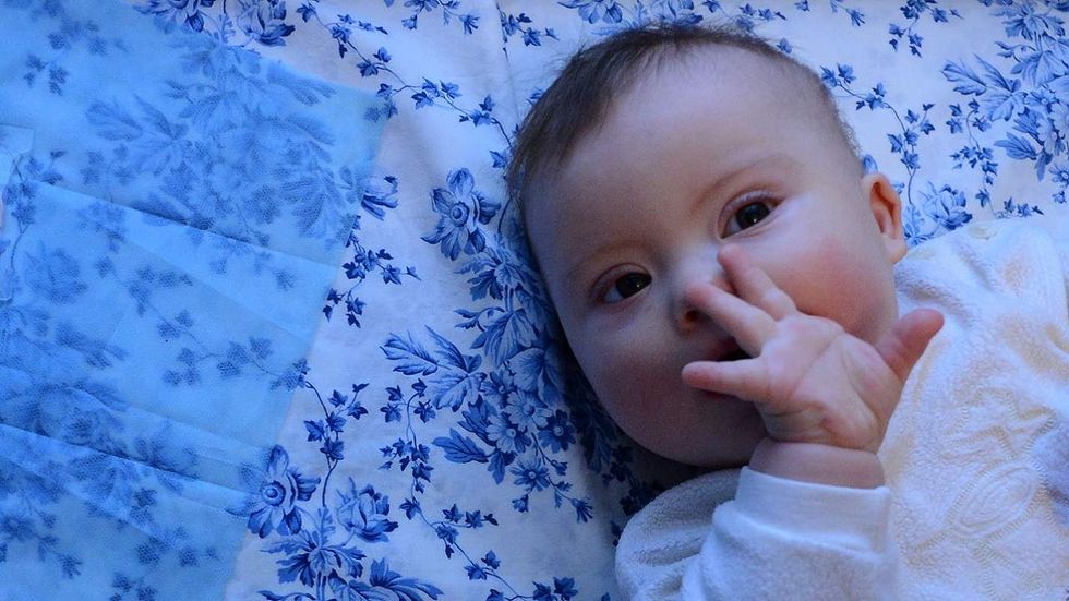 Iceland is ‘eradicating’ this genetic disorder – by eradicating the people who have it