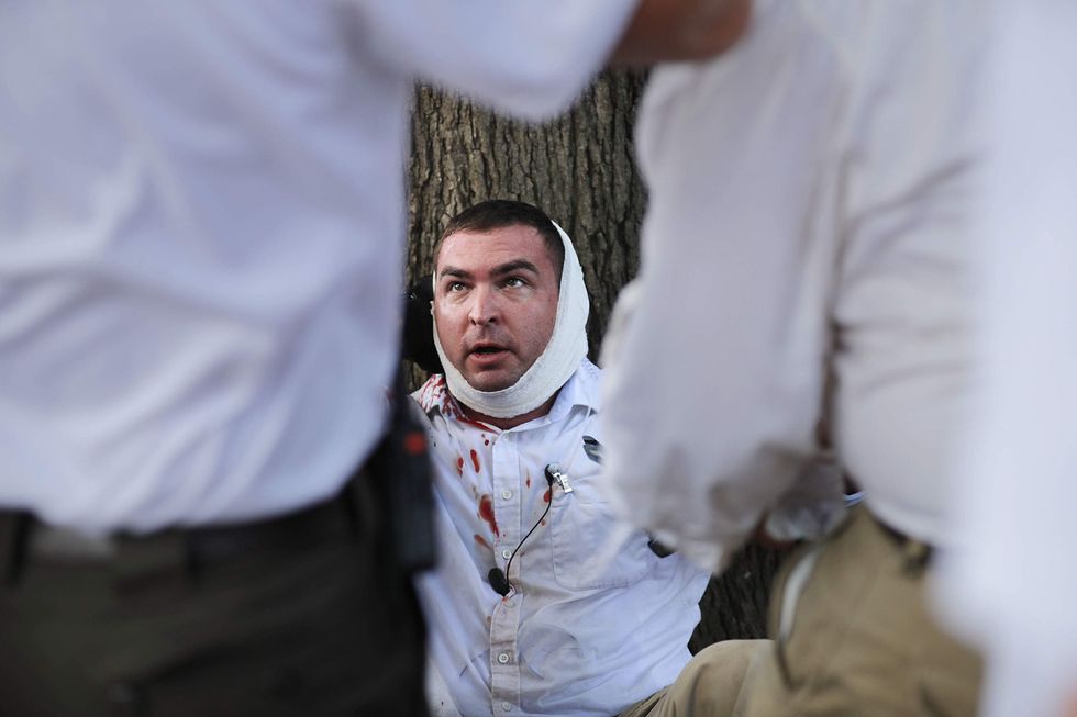 Misidentified: A man was stabbed...because a haircut made him look like a Nazi