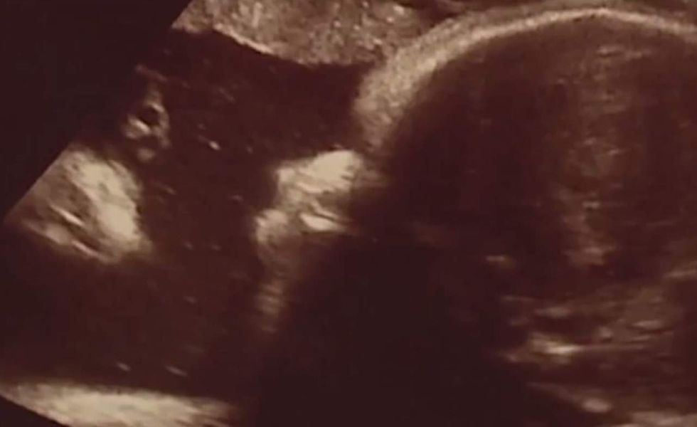 Jesus seen in baby's sonogram: 'It almost brought tears to my eyes ... I was speechless