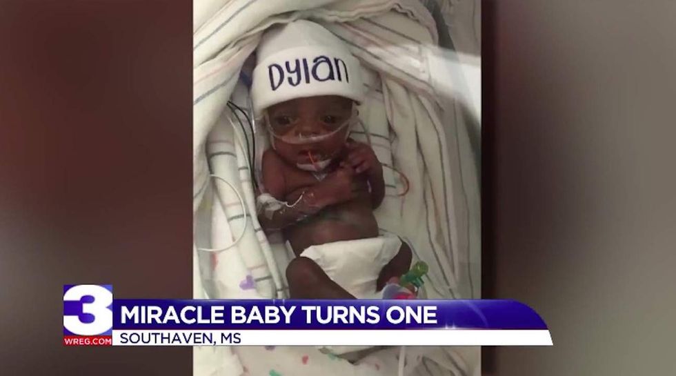 Baby born weighing just 13 ounces celebrates his first birthday