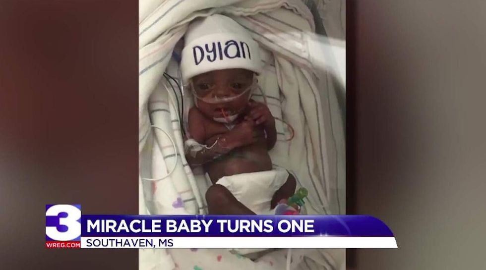 Baby born weighing just 13 ounces celebrates his first birthday