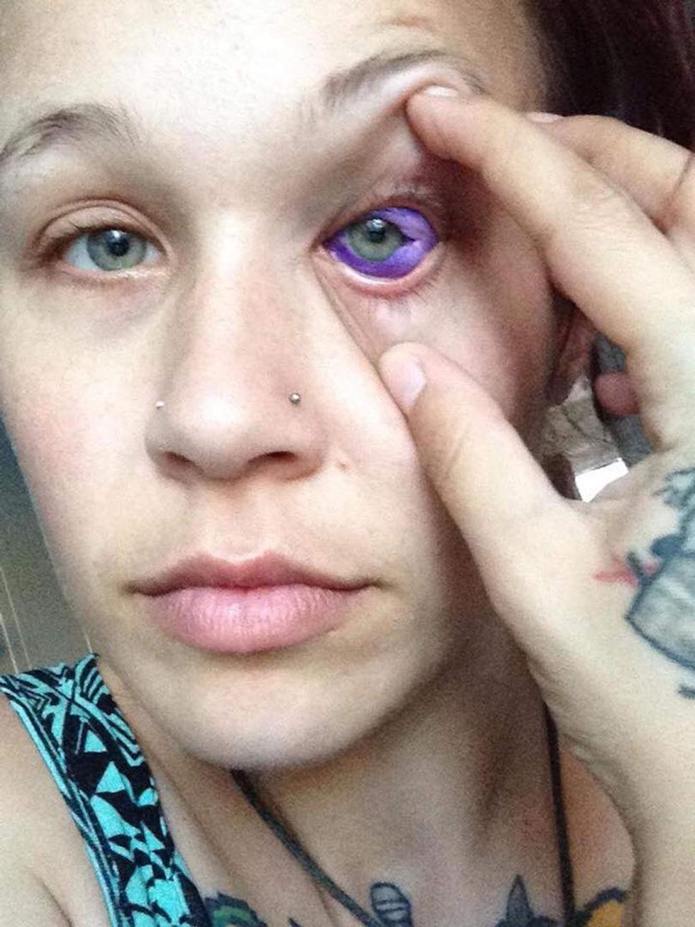 This model got an eyeball tattoo, and of course it went horribly wrong