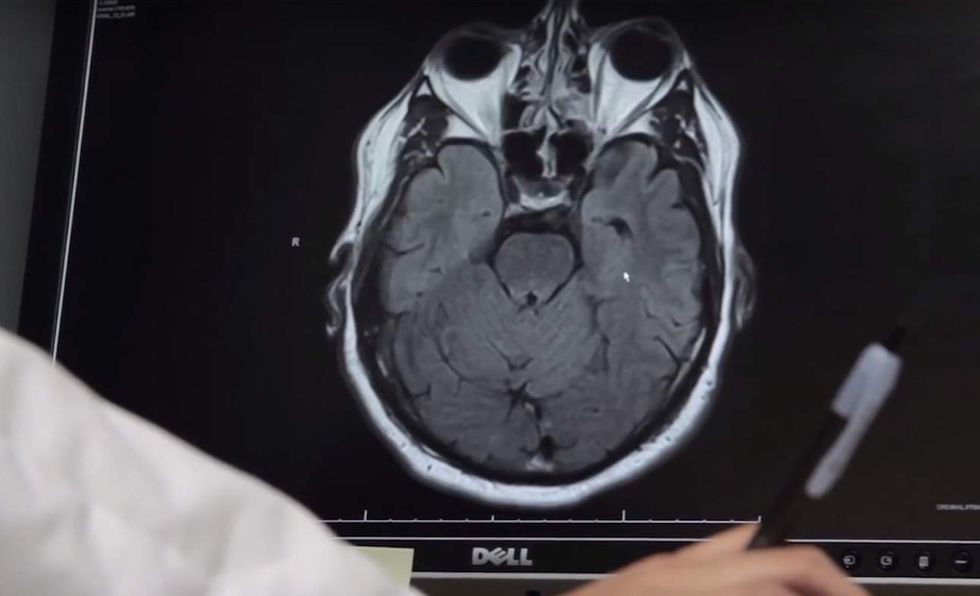 Insane' wait time of 4.5 years for new patients to see specialist, Canadian doctor says