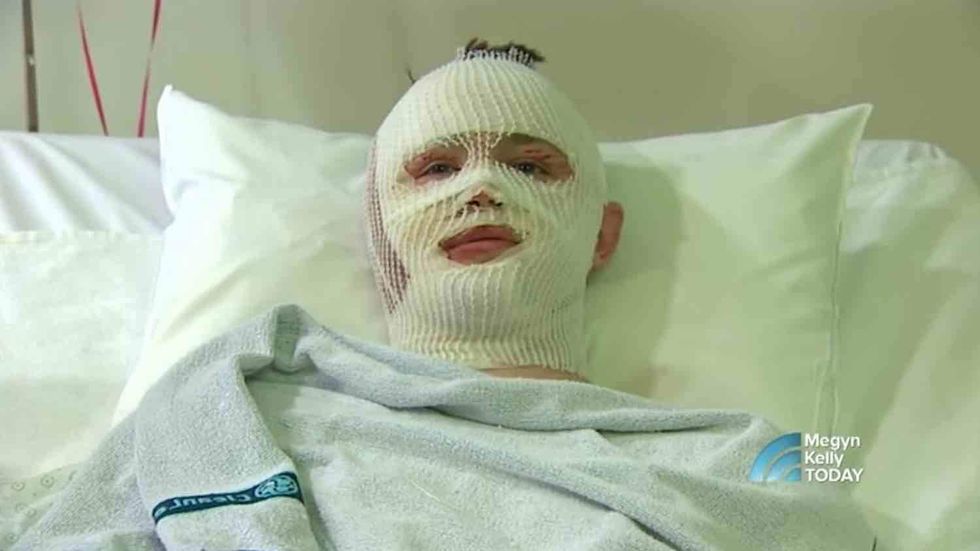 A picture of hell': Terrorists nearly killed him, but he says prayer changed everything