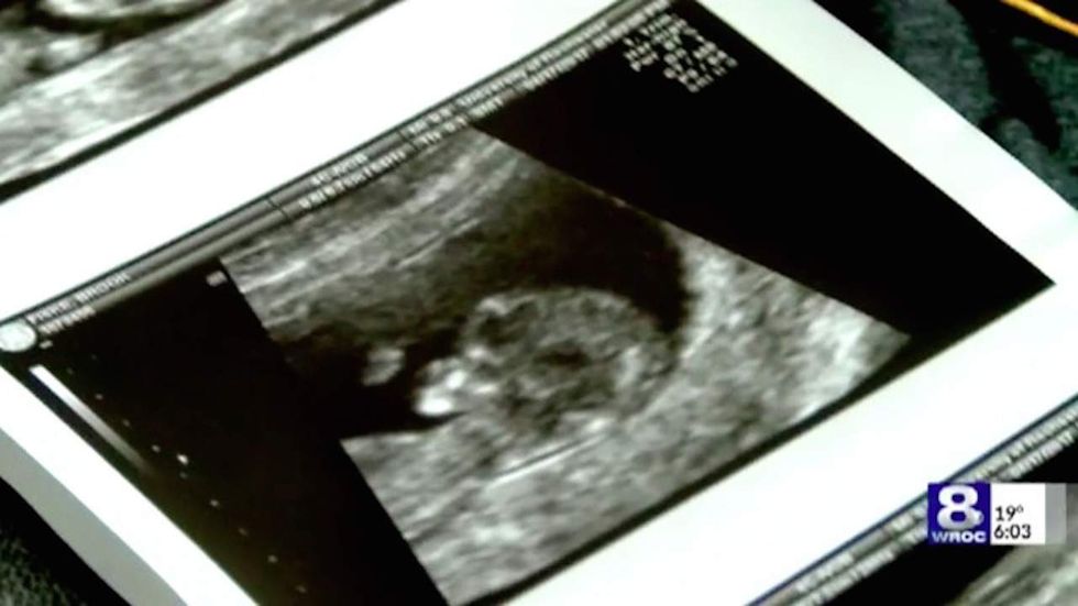 Doctor charged after allegedly slipping abortion pill into his girlfriend's drink