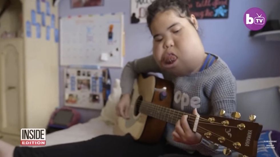 Teenager with rare facial tumor defies expectations after doctors encouraged parents to abort