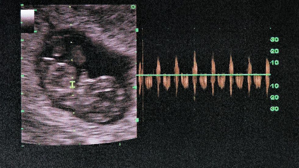 Mississippi lawmakers consider banning most abortions after 15 weeks