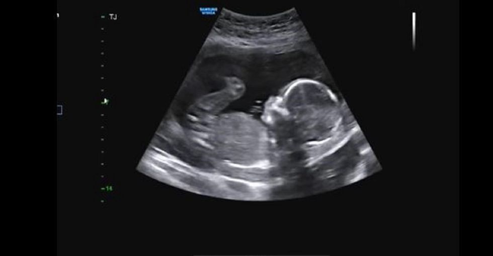 Cast and crew walking off 'Roe v. Wade' film after finding out it's pro-life