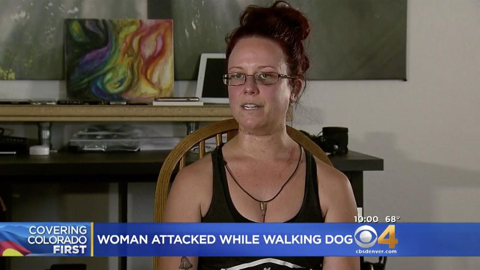 Woman shares graphic pictures of herself after an alleged botched sexual assault