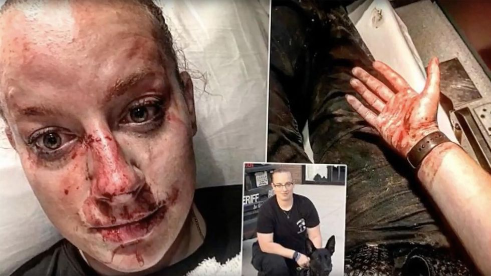 Cop's graphic pics, details of horrific suspect fight meant to give ‘swift kick in the a**’ to cops