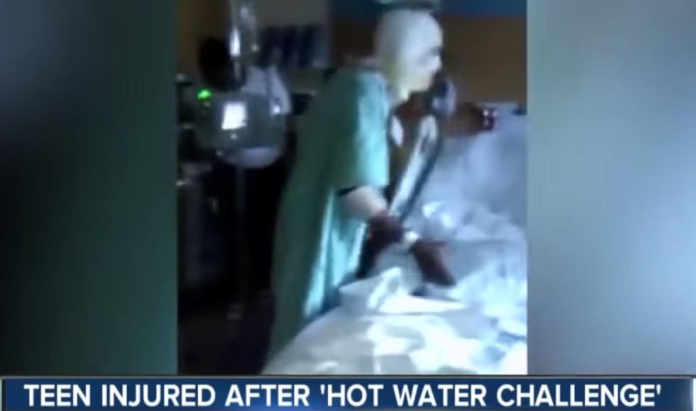 15-year-old suffers horrible injuries because of this online 'challenge' teens are taking