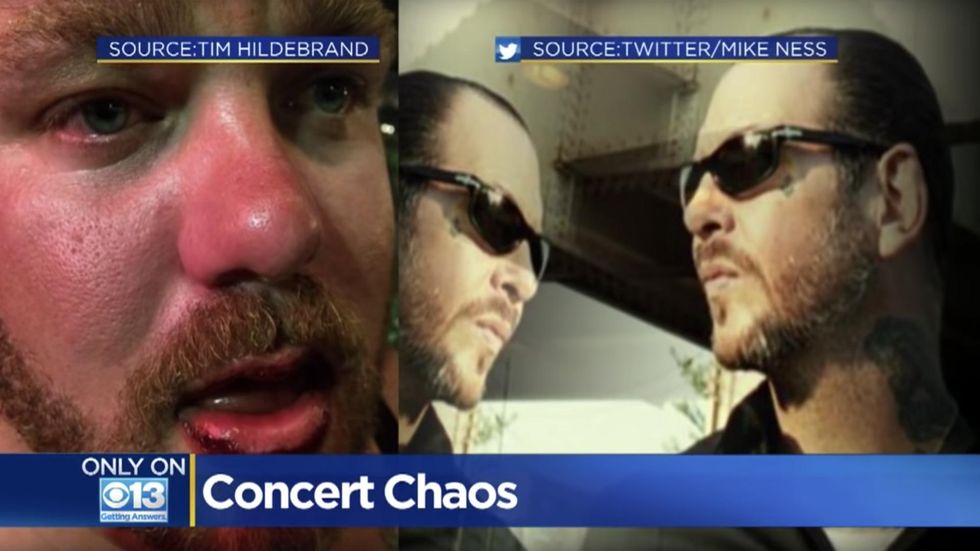 Trump supporter says lead singer of popular band beat him up mid-show over politics