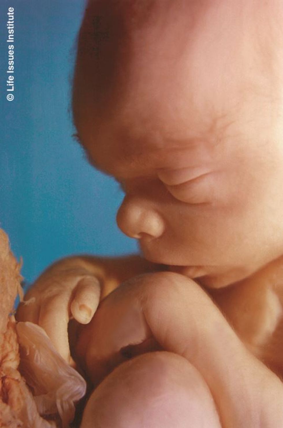 Media Promotes Junk Science on Fetal Pain