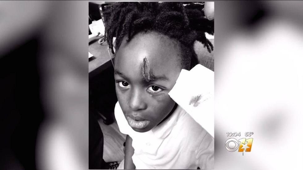 Mother: First-grader hospitalized after bullying at school because teacher was on cell phone