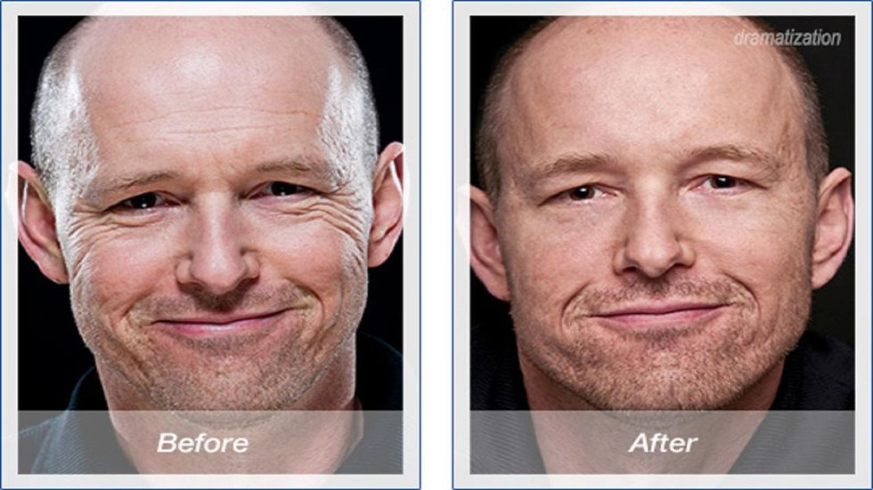 The skin tightener every man should own, period