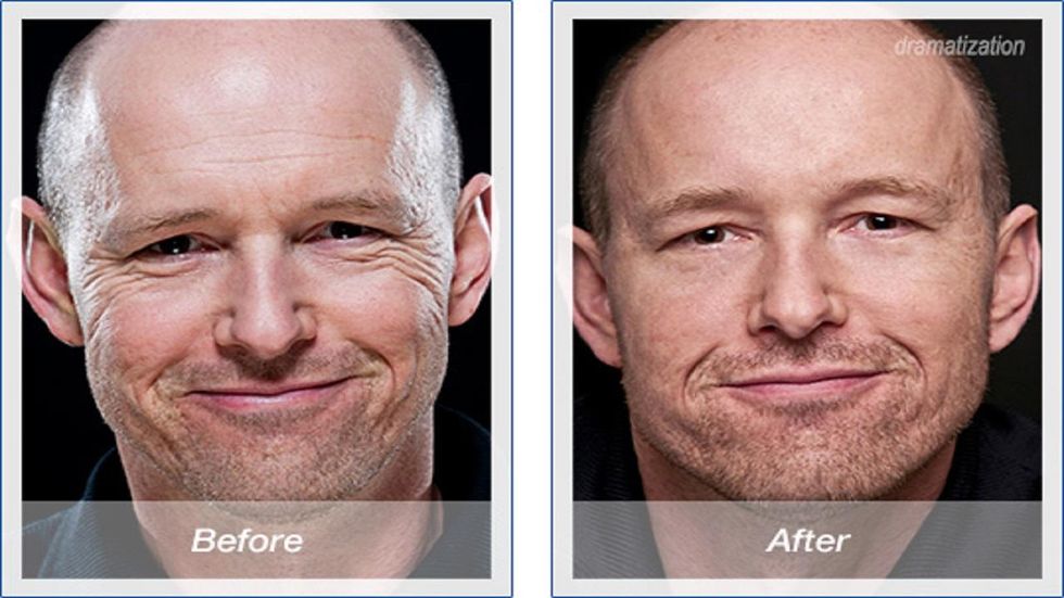 The skin tightener every man should own, period