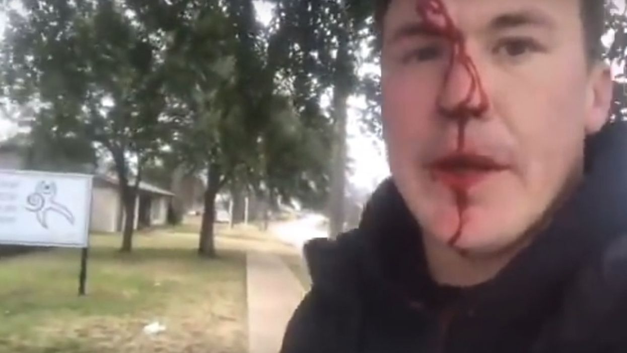 Pro-life activist gets punched, blood drips down his face, after telling unhinged man, 'Jesus loves you'