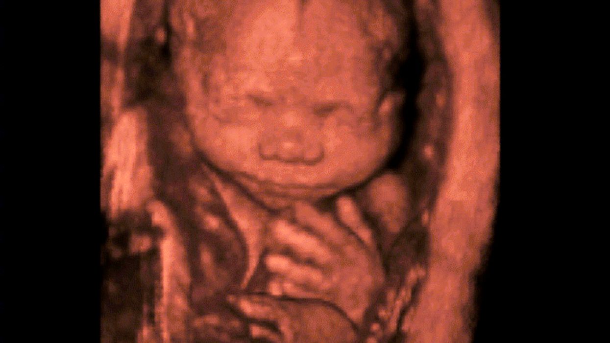 Focus on the Family plans to broadcast live 4D ultrasounds on giant screen in Times Square