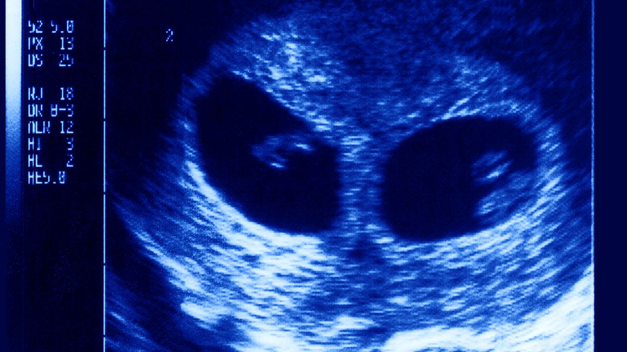 Mother now has healthy twin toddlers after doctors told her to abort them at 4 months pregnant