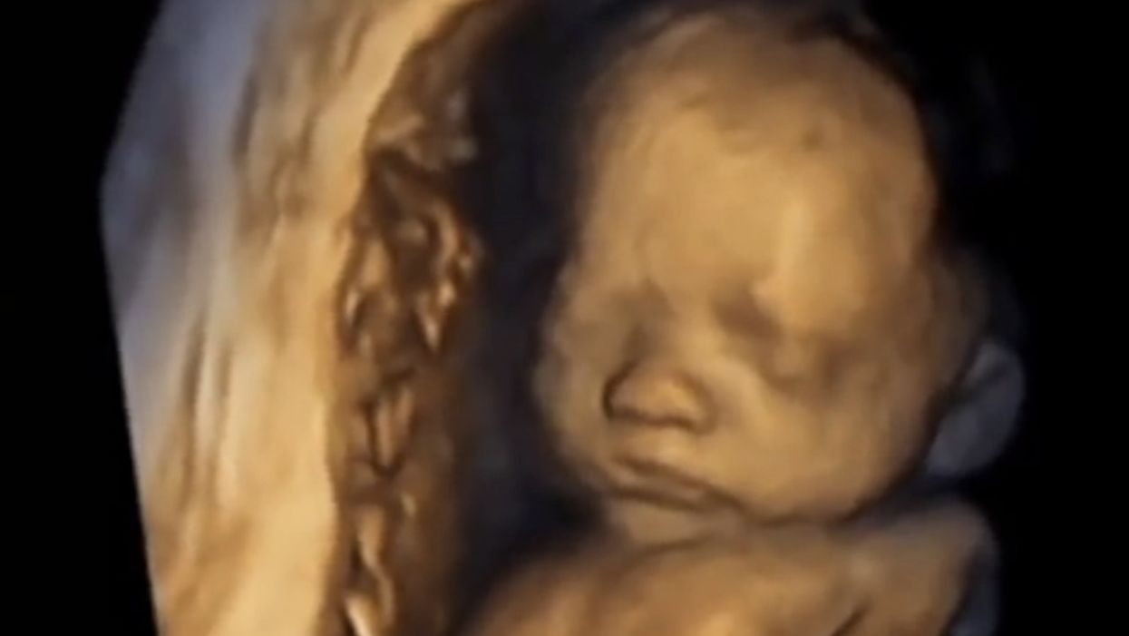 Poll: Jaw-dropping percentage of Americans suddenly shift to pro-life position