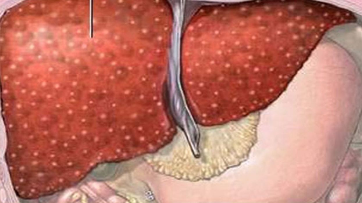 How to: Get rid of 'deep' fat in your stomach