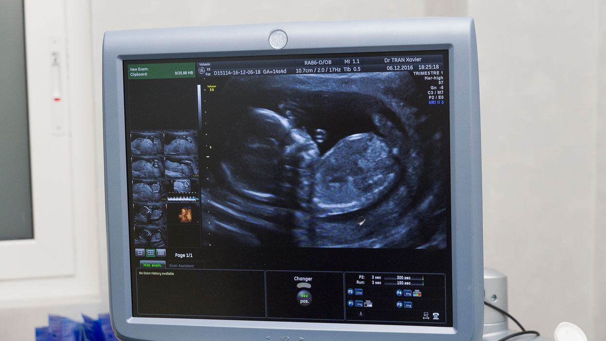 Federal judge overturns North Carolina law banning abortions after 20 weeks