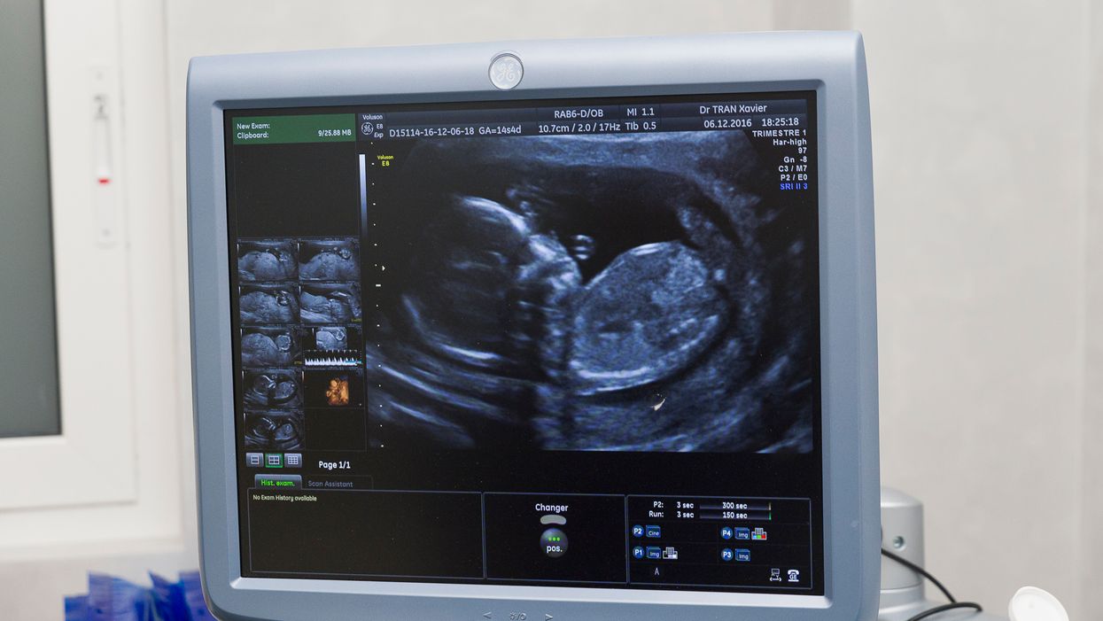 6th Circuit Court of Appeals upholds Kentucky's pro-life ultrasound law