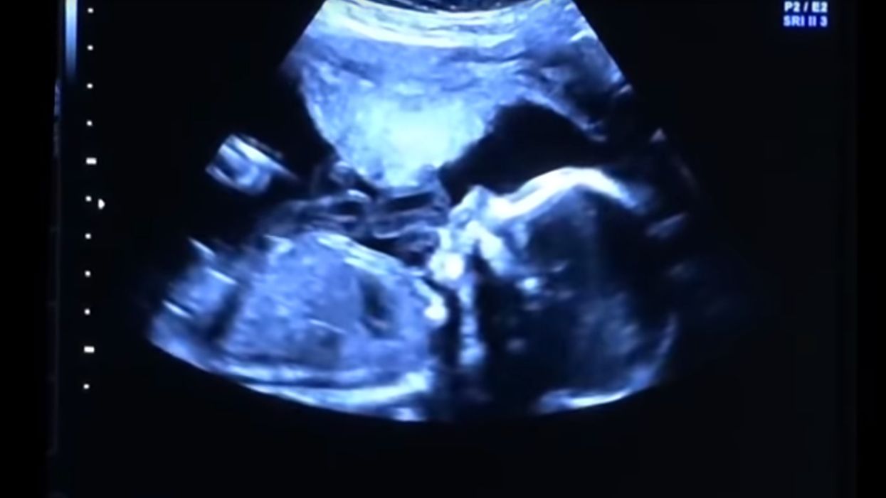 Christian radio station K-LOVE bans ads for pro-life movie ‘Unplanned’ because it’s too ‘political.’ The network changes its tune fast when people get angry.