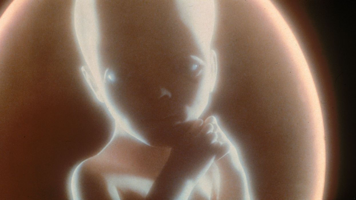 Professor calls unborn babies ‘legitimate parasite,’ compares them to cancer