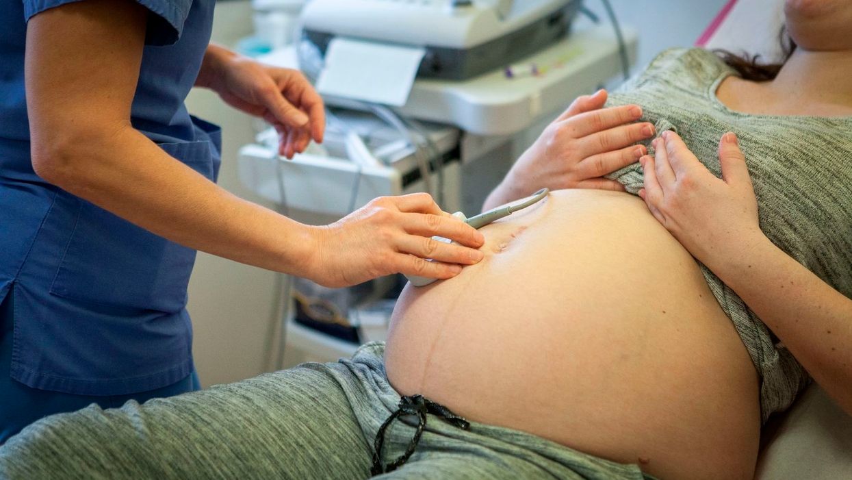 Most people support bans on abortion after fetal heartbeat is detected, poll shows