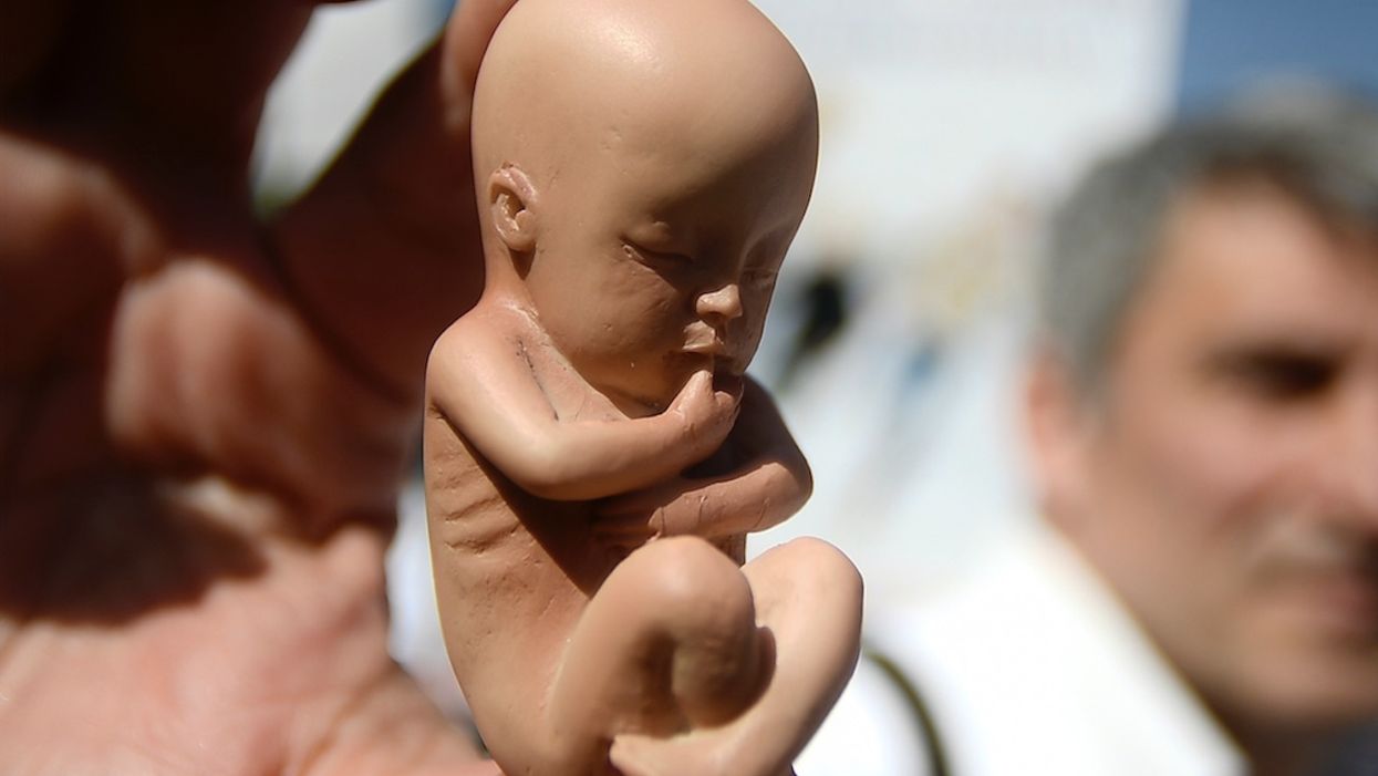 Pro-choice Dem senator calls abortion a 'life-and-death' decision. Huh?
