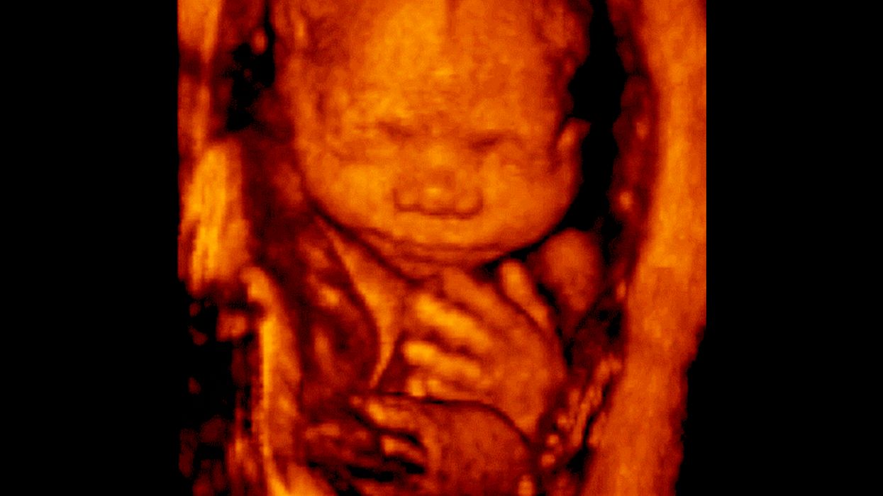 Louisiana state Legislature overwhelmingly passes its own strict pro-life bill — and the Democratic governor says he’ll sign it