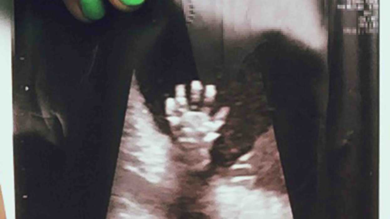 Author poses major abortion challenge to Christians