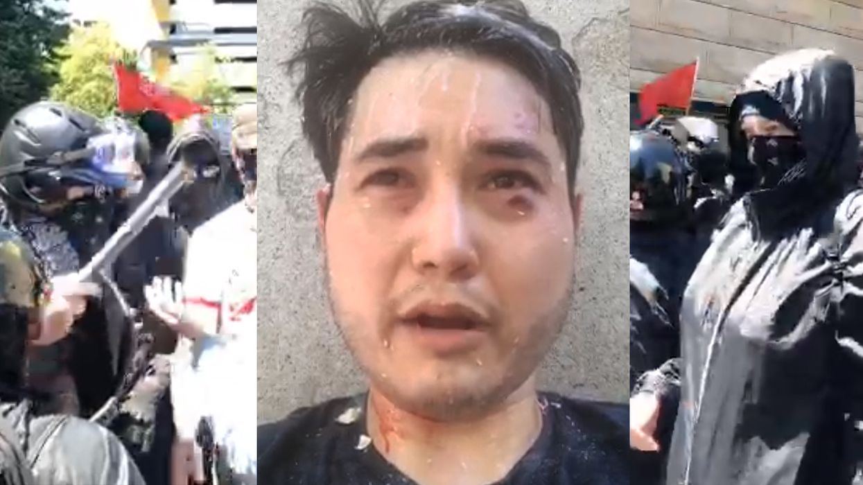 Antifa targets, attacks, sends independent journalist to hospital for filming their 'protest' - and they robbed him too