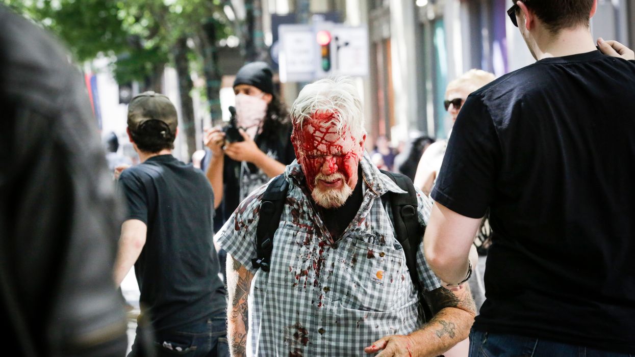 WTF MSM!? Antifa-loving journalists have blood on their keyboards
