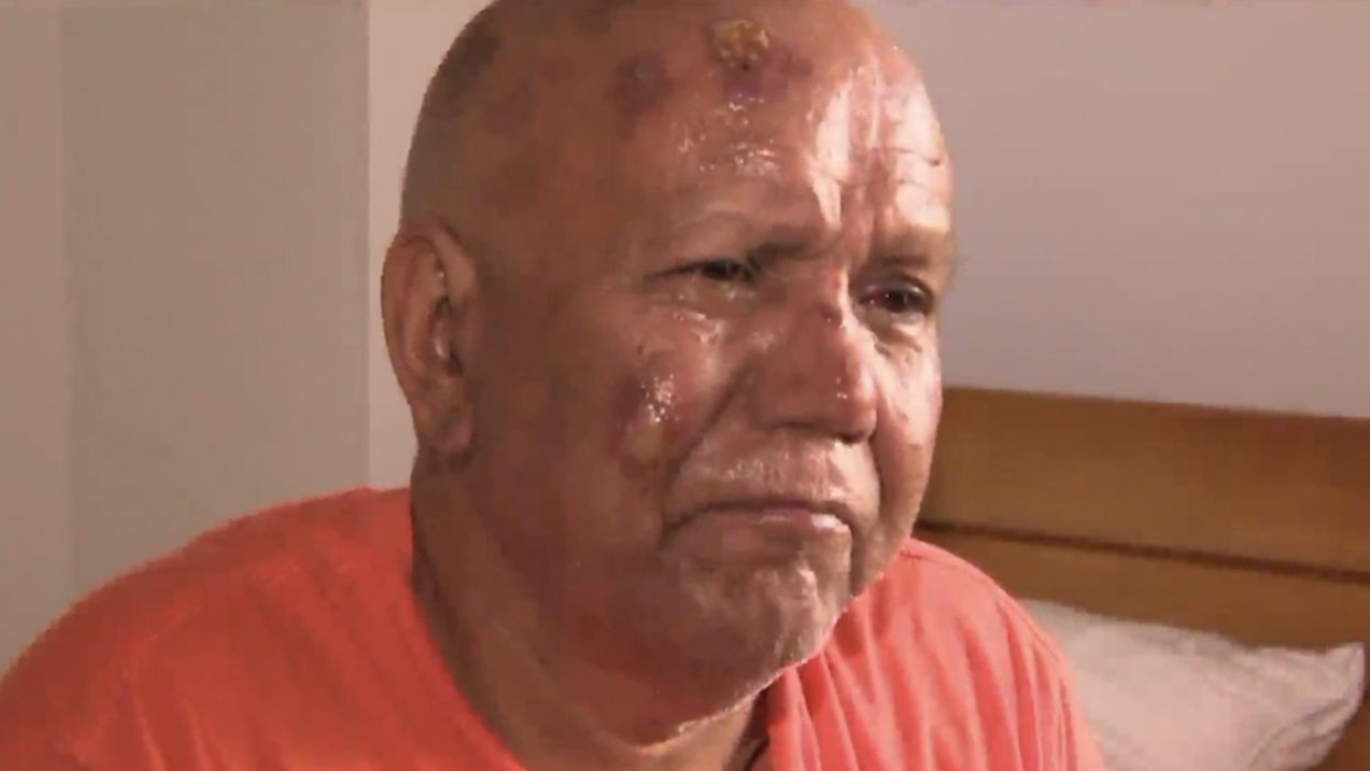 President Trump blamed after physical attack on Hindu priest near NYC temple