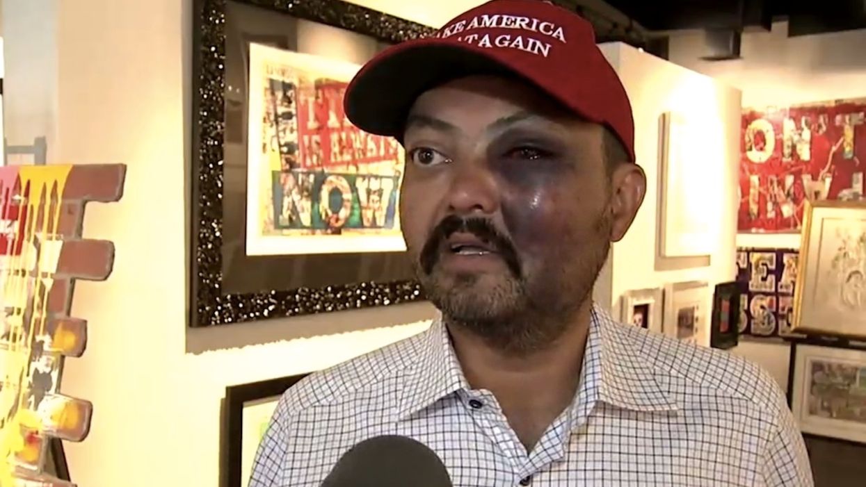 MAGA hat-wearing art gallery owner says teens beat him up on New York City street, yelled 'f*** Trump!'