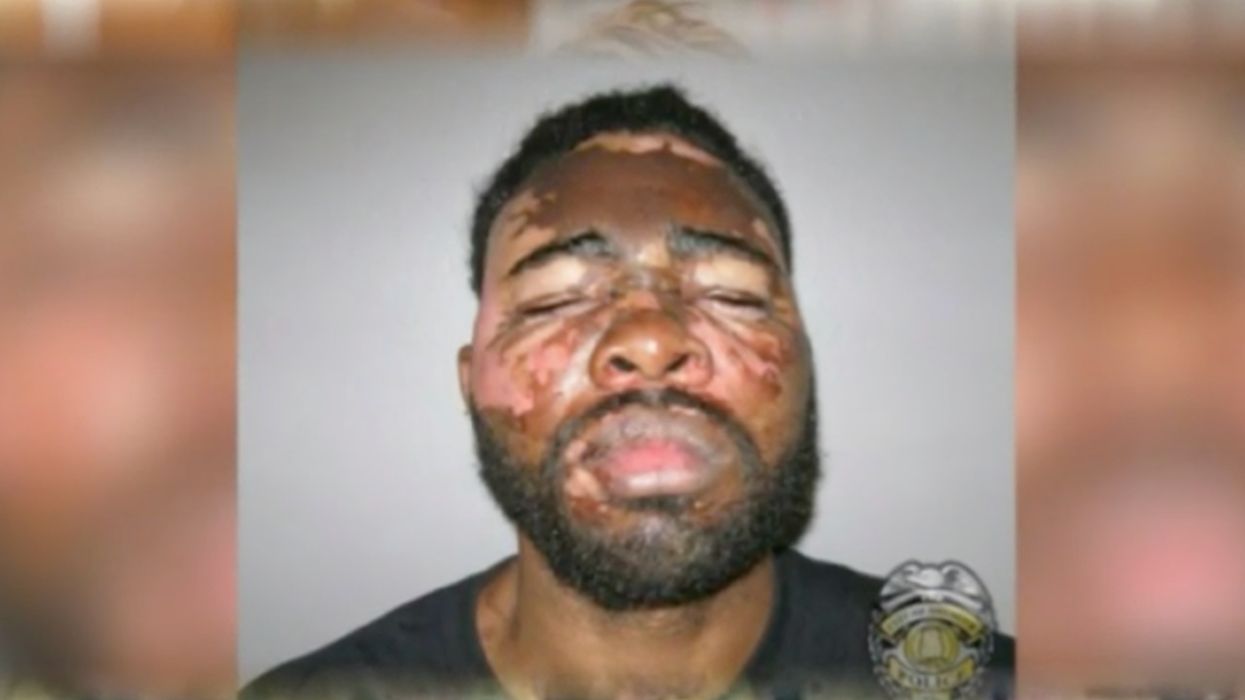 Armed suspect breaks into woman’s home. Good thing she was armed, too — with red-hot cooking grease.