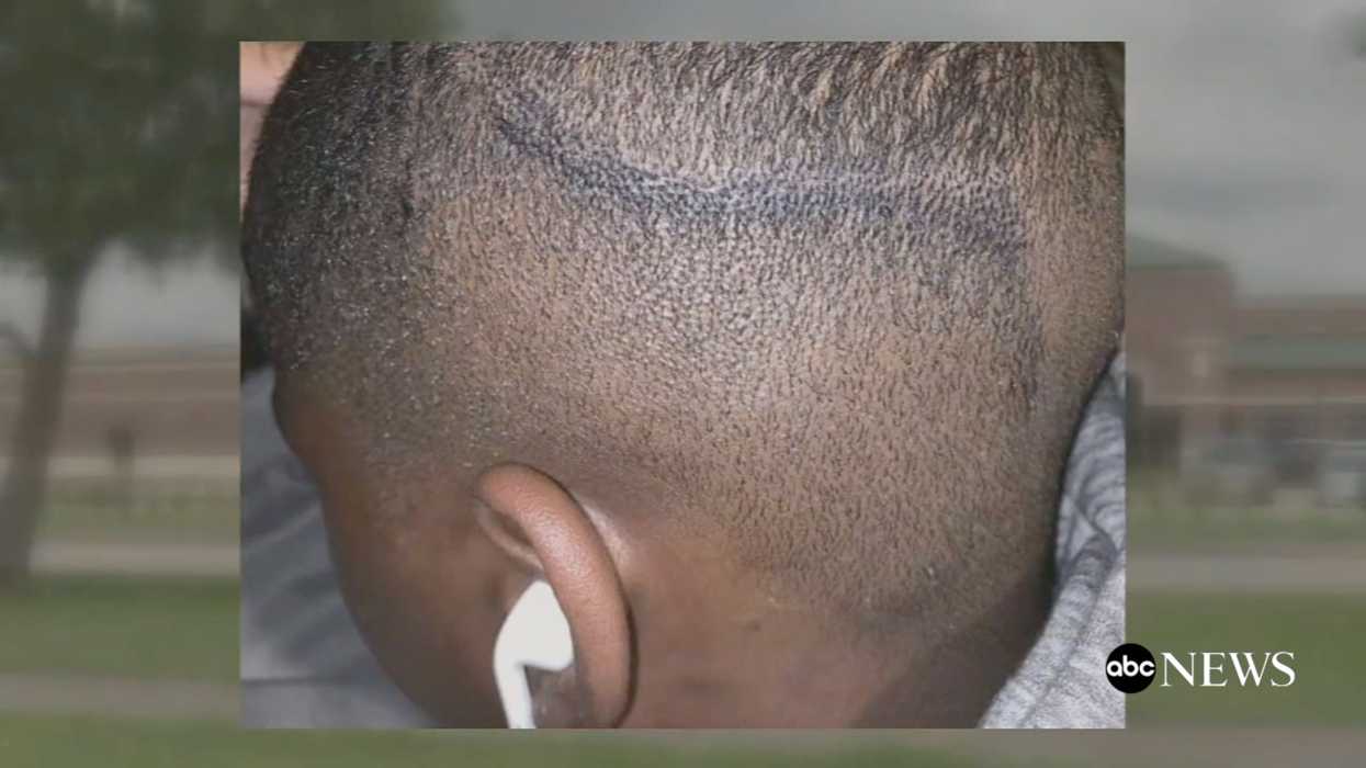 Parents sue Texas school district after school officials reportedly colored in black child’s haircut with permanent black marker