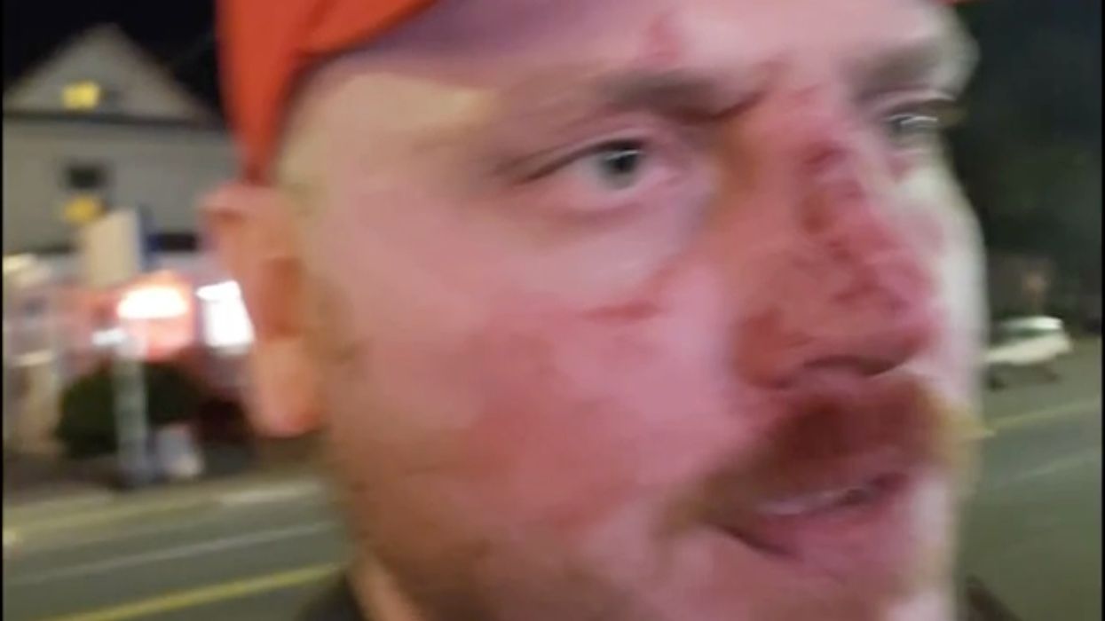 MAGA hat-wearing man says man and woman beat him outside of a Portland bar