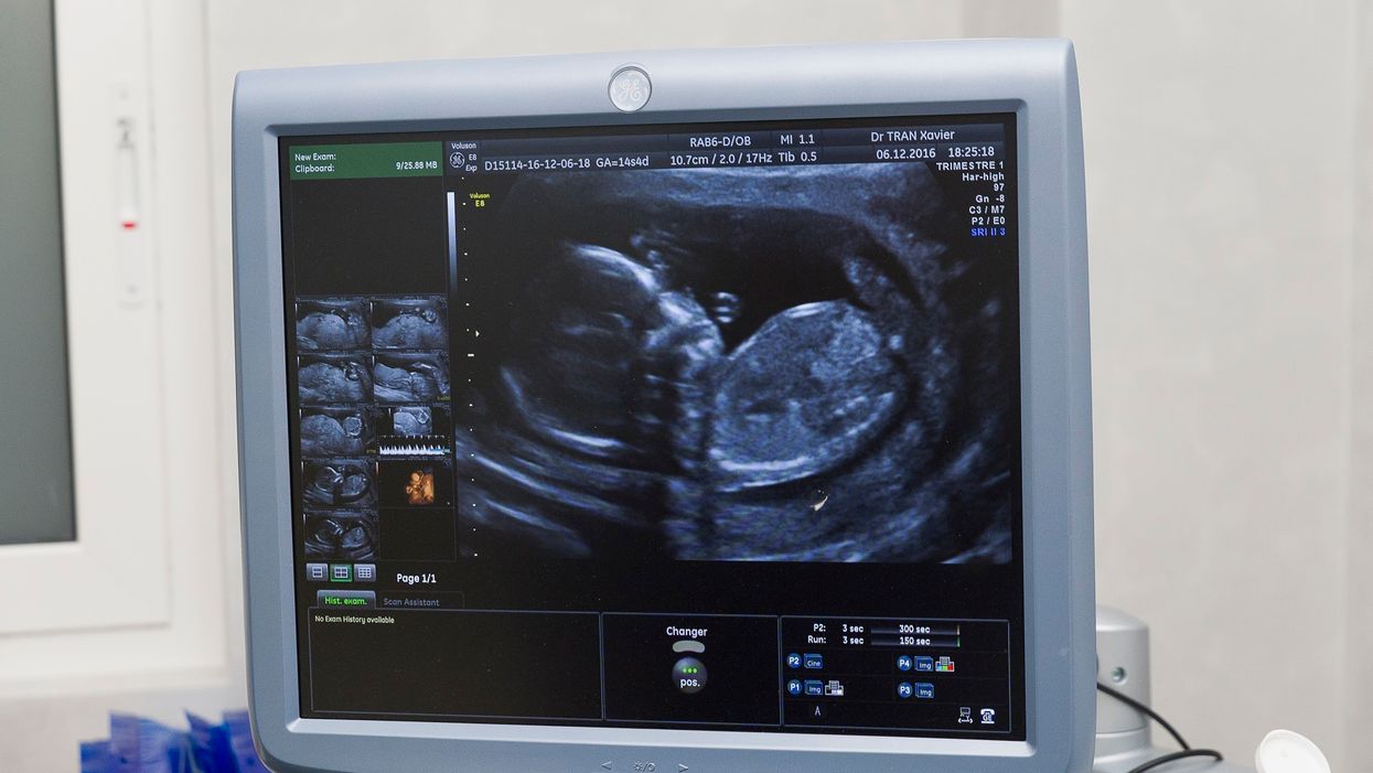 Trump administration urges UN to drop pro-abortion language