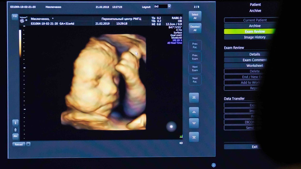 Ex-abortion doctor says that when God 'opened his eyes' about the 'war against babies,' it changed everything for him