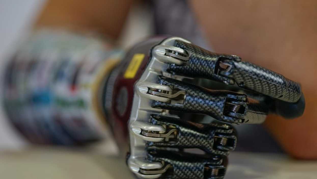 Millenial industrial engineer is changing lives by providing 3D printed prosthetic limbs to people in impoverished countries
