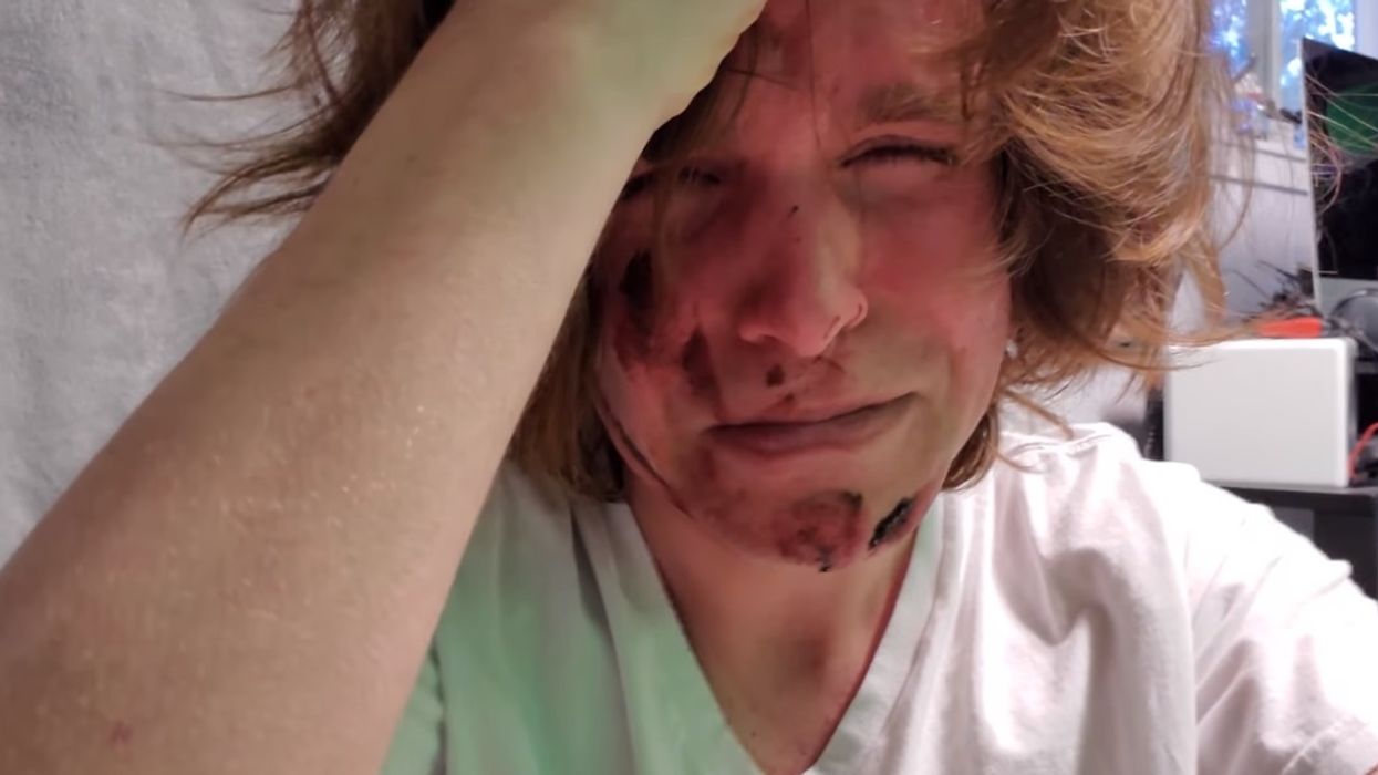 YouTuber Onision melts down in bizarre videos following allegations of 'child grooming' and sexual abuse