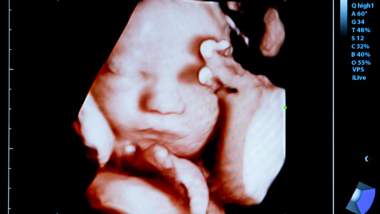 SCOTUS denies First Amendment challenge to Kentucky ultrasound abortion law