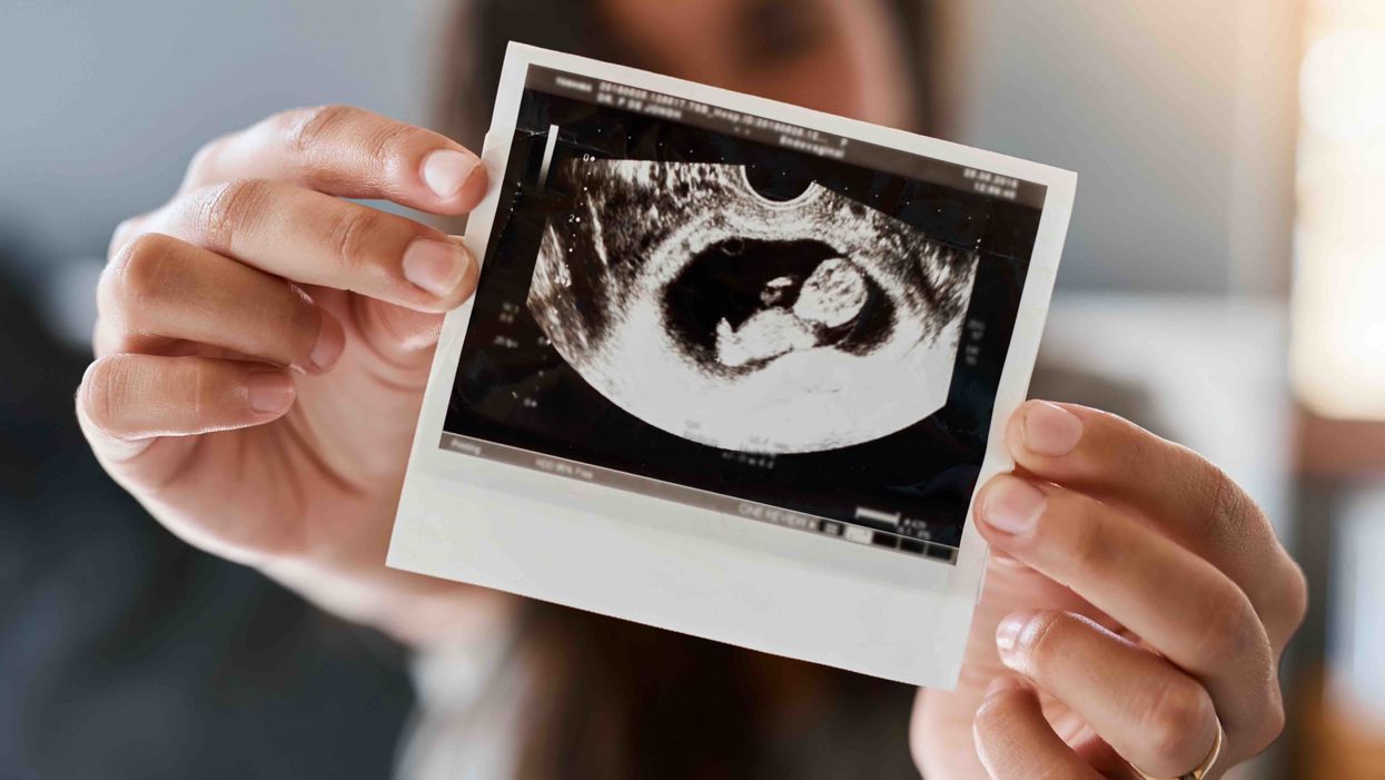 Abby Johnson responds to the pro-choice crowd's claim that unborn babies are 'just tissue': Why is abortion so 'difficult for the woman'?