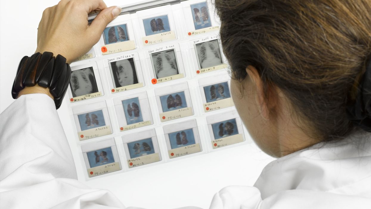 Woman receives devastating cancer diagnosis in doctor's letter — except it was all just a typo